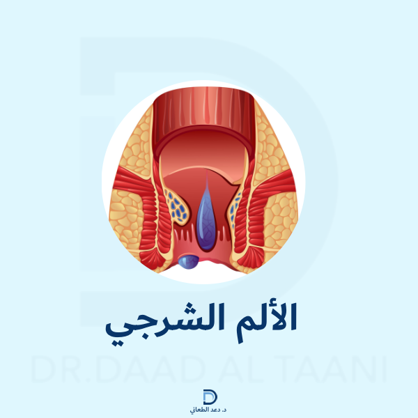 الألم الشرجي