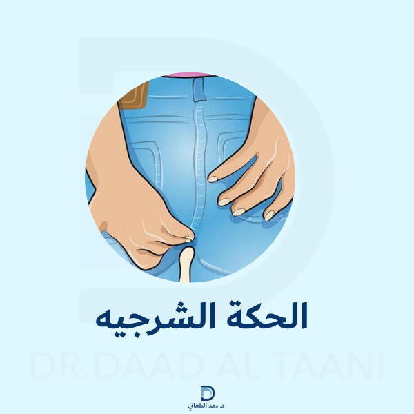 الحكة الشرجية
