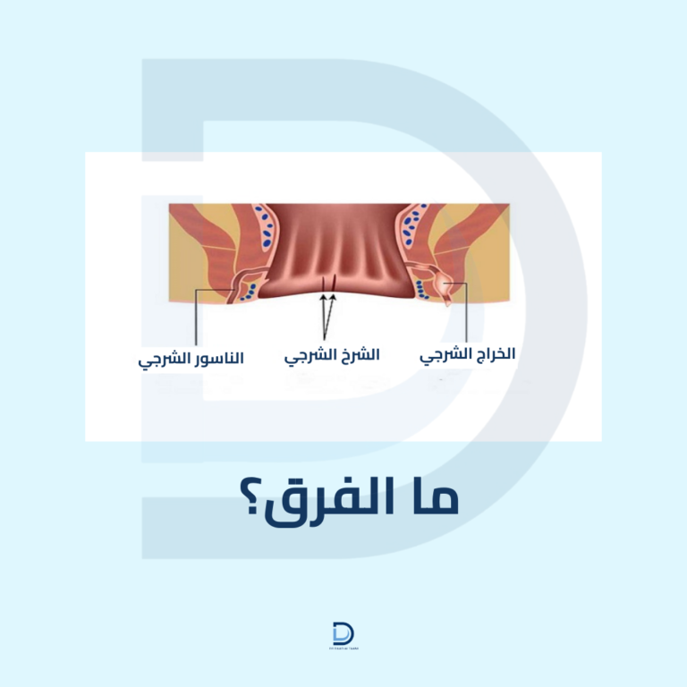 الفبرق بين الناسور والباسور والشق الشرجي من دكتورة دعد الطعانى افضل دكتورة بواسير فى دبي