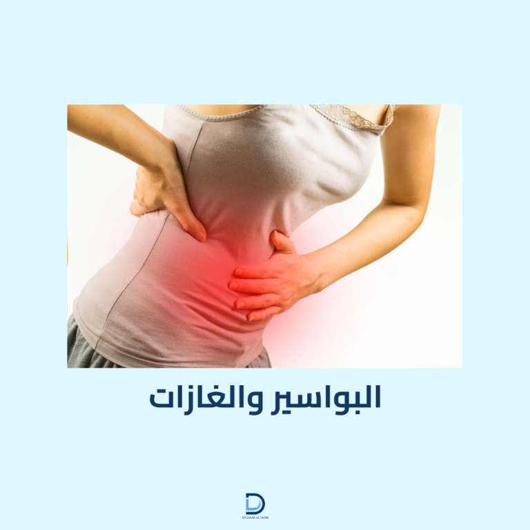 البواسير والغازات