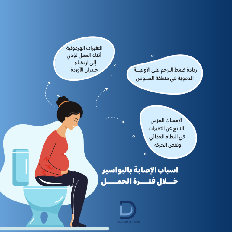 دكتورة النساء لعلاج البواسير