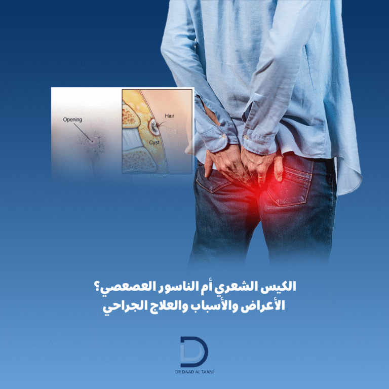 الناسور العصعصي أعراضه وأسبابه وطرق العلاج مع الدكتورة دعد الطعاني