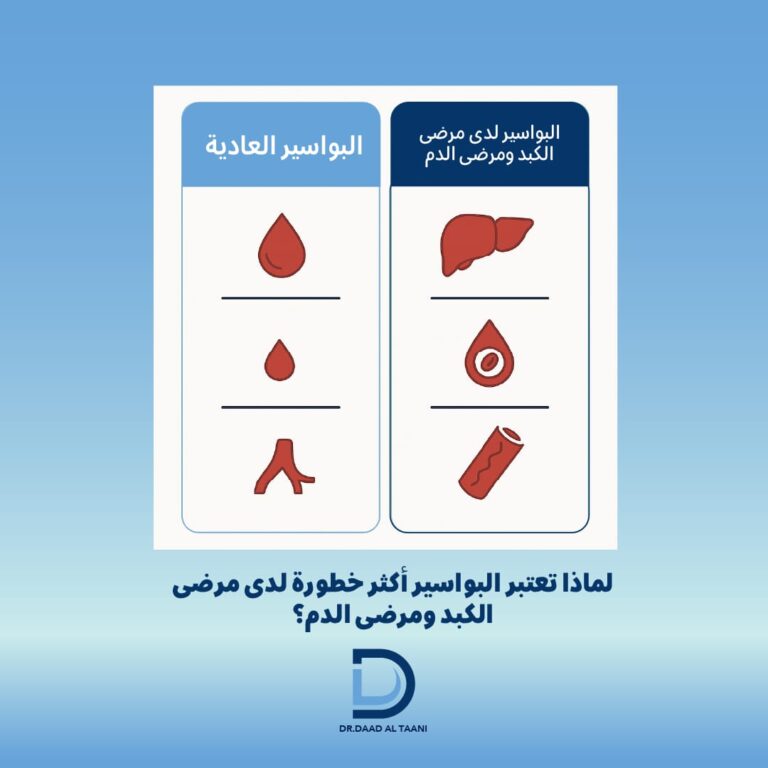 البواسير لدى مرضى الكبد ومرضى الدم