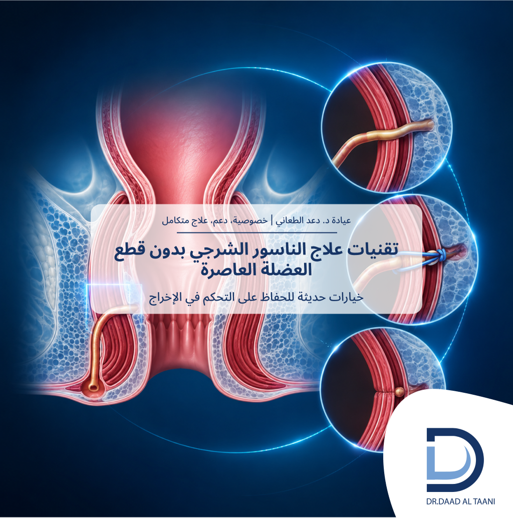 تقنيات علاج الناسور الشرجي بدون قطع العضلة العاصرة مع عيادة د